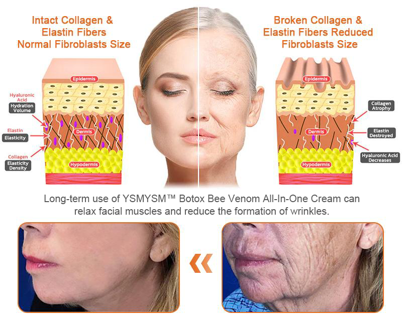Only 5 jars! Grab an exclusive 50% discount now! Keep your skin youthful and glowing in just 1 to 4 weeks. Don’t miss your chance—this offer won’t come around again until next year. Act fast! 180-day money back guarantee!