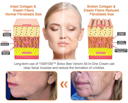 Only 5 jars! Grab an exclusive 50% discount now! Keep your skin youthful and glowing in just 1 to 4 weeks. Don’t miss your chance—this offer won’t come around again until next year. Act fast! 180-day money back guarantee!