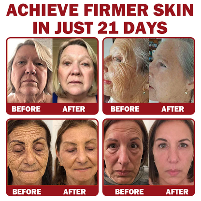 Only 5 jars! Grab an exclusive 50% discount now! Keep your skin youthful and glowing in just 1 to 4 weeks. Don’t miss your chance—this offer won’t come around again until next year. Act fast! 180-day money back guarantee!