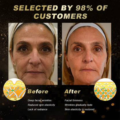 Mayo Clinic Recommended | Official Shop | YSMYSM®  Botox Skin Treatment Cream Anti-aging, Hydrating, Skin Repair, Even Tone, Acne and Dark Spot Treatment, Wart and Mole Removal, Psoriasis Relief