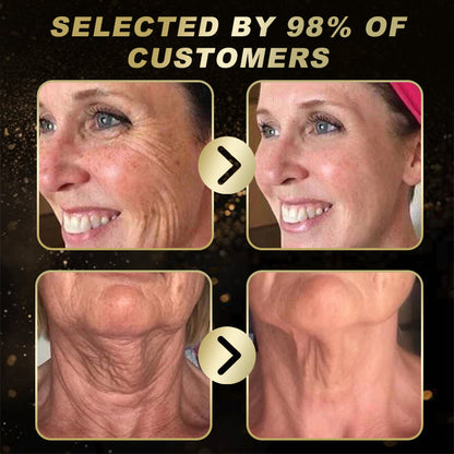 Mayo Clinic Recommended | Official Shop | YSMYSM®  Botox Skin Treatment Cream Anti-aging, Hydrating, Skin Repair, Even Tone, Acne and Dark Spot Treatment, Wart and Mole Removal, Psoriasis Relief