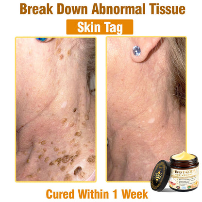 Only 5 jars! Grab an exclusive 50% discount now! Keep your skin youthful and glowing in just 1 to 4 weeks. Don’t miss your chance—this offer won’t come around again until next year. Act fast! 180-day money back guarantee!