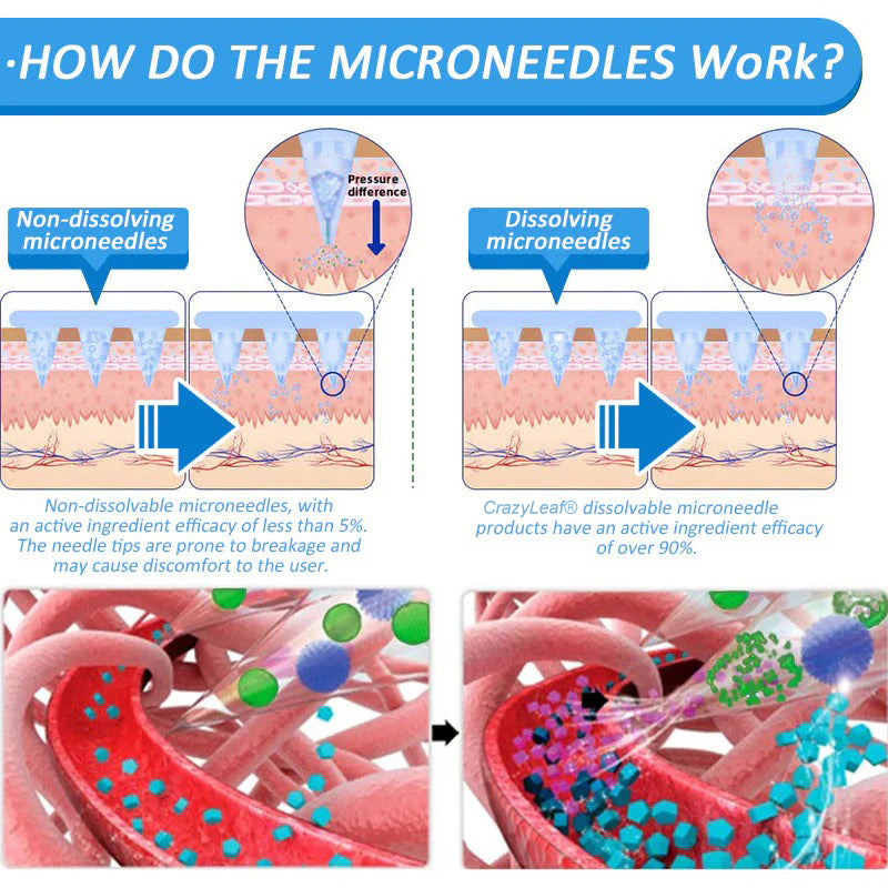 【Last Day Promotion 80% OFF🔥】 CrazyLeaf® 💙 Nano Microneedle Patch with SMGT-GLP-1, Matrixyl 3000, Botox & Collagen Peptides – Targets: Obesity, Skin Firmness, Cardiovascular Disease, Diabetes, Sleep Apnea, Joint Issues, and More