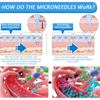 【Last Day Promotion 80% OFF🔥】 CrazyLeaf® 💙 Nano Microneedle Patch with SMGT-GLP-1, Matrixyl 3000, Botox & Collagen Peptides – Targets: Obesity, Skin Firmness, Cardiovascular Disease, Diabetes, Sleep Apnea, Joint Issues, and More