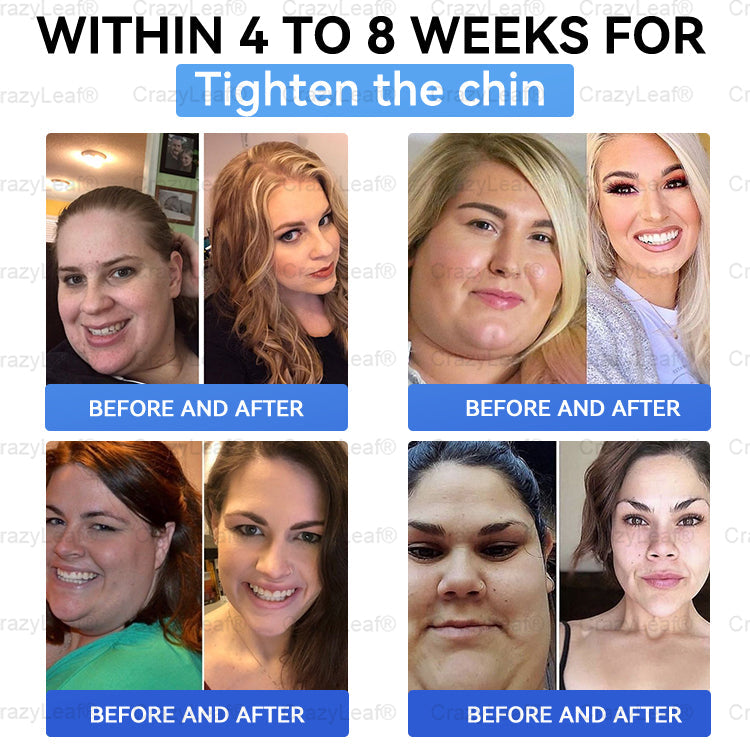 Only 10 boxes left! We're offering you an additional 40% discount! Get yourself in shape and healthy. Miss out now, and you won't have another chance until next year.CrazyLeaf®