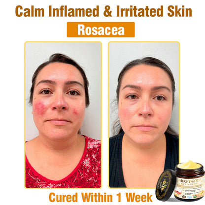 Only 5 jars! Grab an exclusive 50% discount now! Keep your skin youthful and glowing in just 1 to 4 weeks. Don’t miss your chance—this offer won’t come around again until next year. Act fast! 180-day money back guarantee!