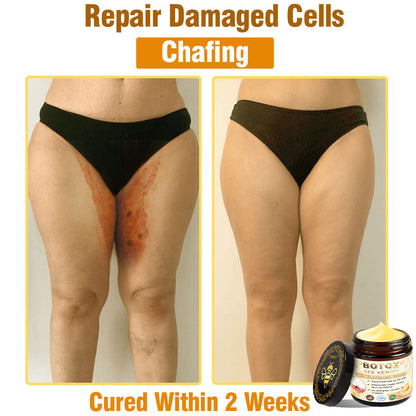 Only 5 jars! Grab an exclusive 50% discount now! Keep your skin youthful and glowing in just 1 to 4 weeks. Don’t miss your chance—this offer won’t come around again until next year. Act fast! 180-day money back guarantee!