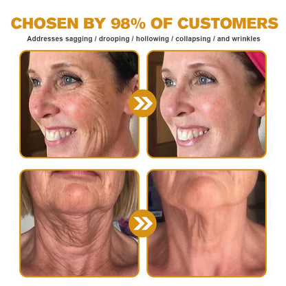 Only 5 jars! Grab an exclusive 50% discount now! Keep your skin youthful and glowing in just 1 to 4 weeks. Don’t miss your chance—this offer won’t come around again until next year. Act fast! 180-day money back guarantee!