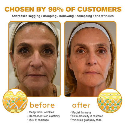 Only 5 jars! Grab an exclusive 50% discount now! Keep your skin youthful and glowing in just 1 to 4 weeks. Don’t miss your chance—this offer won’t come around again until next year. Act fast! 180-day money back guarantee!